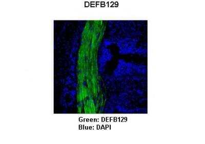 Immunohistochemistry: DEFB129 Antibody [NBP2-82832]