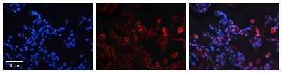 Immunohistochemistry: DEGS1 Antibody [NBP1-59941]