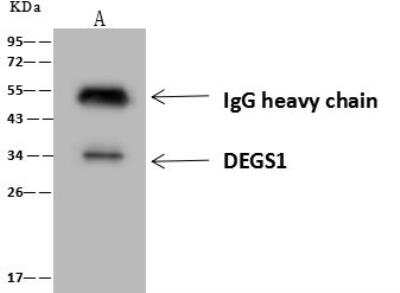 Immunoprecipitation: DEGS1 Antibody [NBP3-12689]