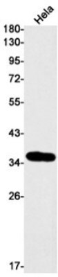 Western Blot: DEGS1 Antibody (S03-5D2) [NBP3-19964]