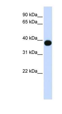 Western Blot: DEGS1 Antibody [NBP1-59941]