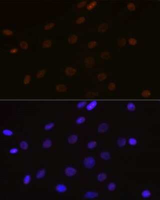 Immunocytochemistry/ Immunofluorescence: DEK Antibody (2C2V8) [NBP3-15257]