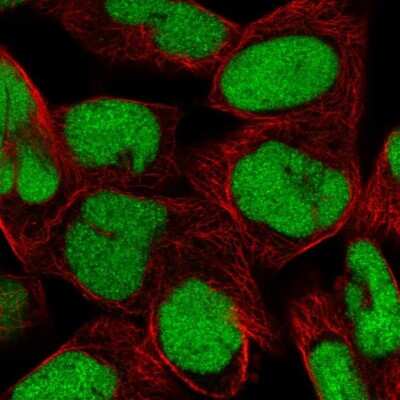 Immunocytochemistry/ Immunofluorescence: DEK Antibody [NBP2-38834]