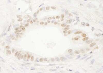 Immunohistochemistry: DEK Antibody [NB100-61058]