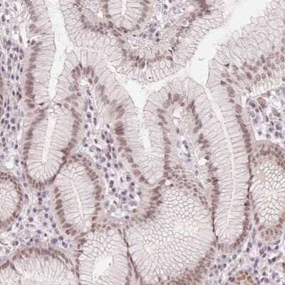 Immunohistochemistry: DEK Antibody [NBP2-49135]