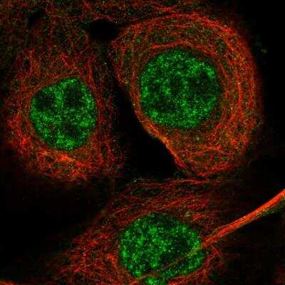 Immunocytochemistry/ Immunofluorescence: DEM1 Antibody [NBP1-88493]