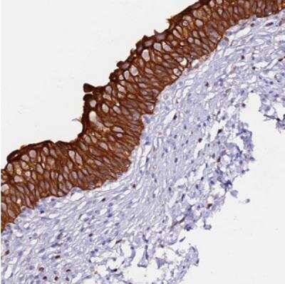 Immunohistochemistry: DENN/MADD Domain Containing 2D Antibody [NBP2-30995]