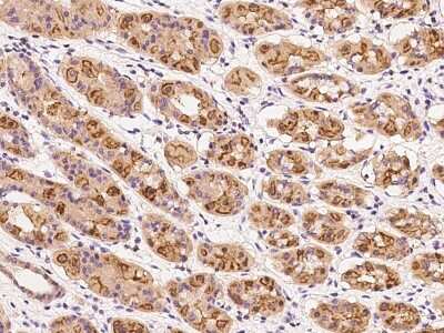 Immunohistochemistry-Paraffin: DENN/MADD Domain Containing 2D Antibody [NBP2-97542]