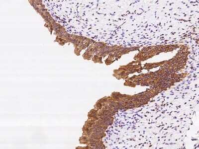 Immunohistochemistry-Paraffin: DENN/MADD Domain Containing 2D Antibody [NBP2-97542]