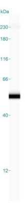 Simple Western: DENN/MADD Domain Containing 2D Antibody [NBP2-30995]