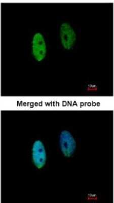 Immunocytochemistry/ Immunofluorescence: DENND1B Antibody [NBP1-32715]