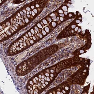 Immunohistochemistry: DENND1B Antibody [NBP2-47486]