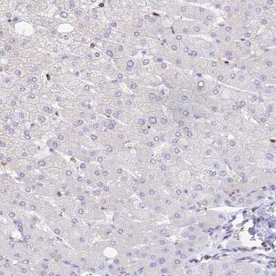 Immunohistochemistry-Paraffin: DENND1C Antibody [NBP1-94051]