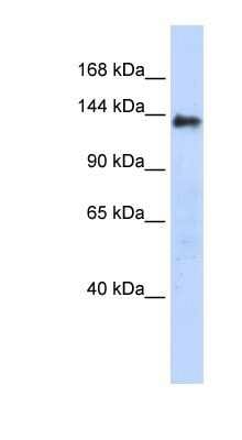 Western Blot: DENND2C Antibody [NBP1-79530]