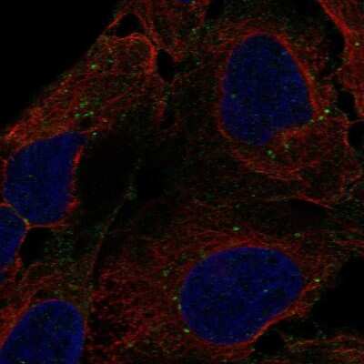 Immunocytochemistry/ Immunofluorescence: DENND3 Antibody [NBP2-55190]