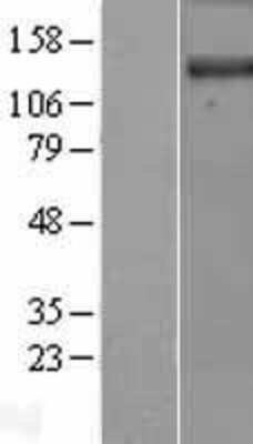 Western Blot: DENND3 Overexpression Lysate [NBL1-09830]