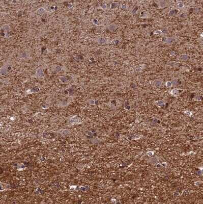 Immunohistochemistry-Paraffin: DENND5B Antibody [NBP2-31971]