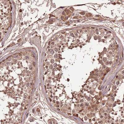 Immunohistochemistry-Paraffin: DENR Antibody [NBP2-13913]
