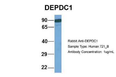 Western Blot: DEPDC1A Antibody [NBP2-84002]