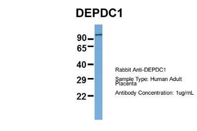 Western Blot: DEPDC1A Antibody [NBP2-84002]