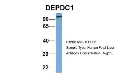 Western Blot: DEPDC1A Antibody [NBP2-84002]