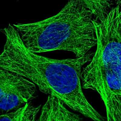 Immunocytochemistry/ Immunofluorescence: DEPDC4 Antibody [NBP1-90592]