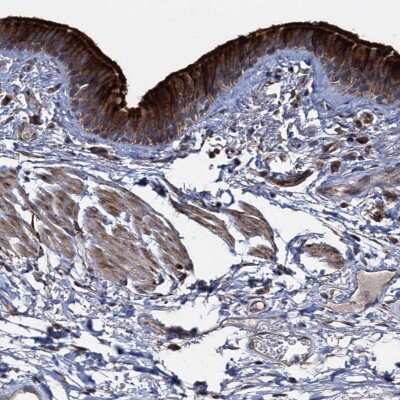 Immunohistochemistry-Paraffin: DEPDC4 Antibody [NBP1-90592]