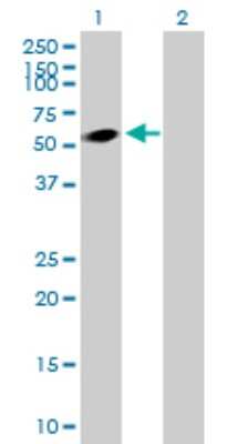 Western Blot: DEPDC7 Antibody [H00091614-B01P]