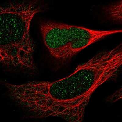 Immunocytochemistry/ Immunofluorescence: DERA Antibody [NBP2-58642]