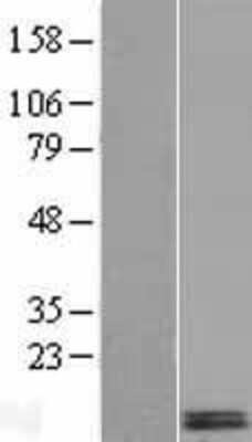 Western Blot: DEXI Overexpression Lysate [NBL1-09841]