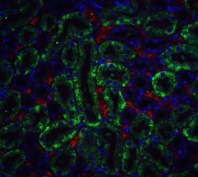 Immunocytochemistry/ Immunofluorescence: DFF40/CAD Antibody - BSA Free [NBP1-77009]