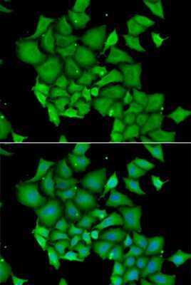 Immunocytochemistry/ Immunofluorescence: DFF45/ICAD Antibody - BSA Free [NBP3-03452]