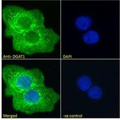 Immunocytochemistry/ Immunofluorescence: DGAT1 Antibody [NB100-57086]