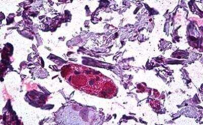 Immunohistochemistry-Paraffin: DGAT1 Antibody [NB100-57086]