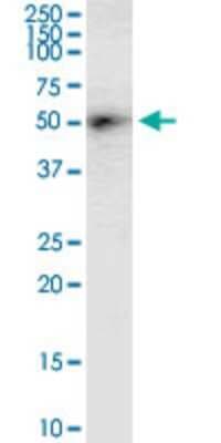 Western Blot: DGAT2 Antibody (4C1) [H00084649-M03]