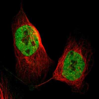 Immunocytochemistry/ Immunofluorescence: DGCR14 Antibody [NBP1-84258]