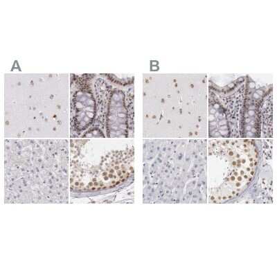 Immunohistochemistry-Paraffin: DGCR14 Antibody [NBP1-84257]