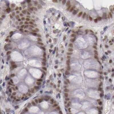 Immunohistochemistry-Paraffin: DGCR14 Antibody [NBP1-84257]
