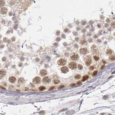 Immunohistochemistry-Paraffin: DGCR14 Antibody [NBP1-84257]