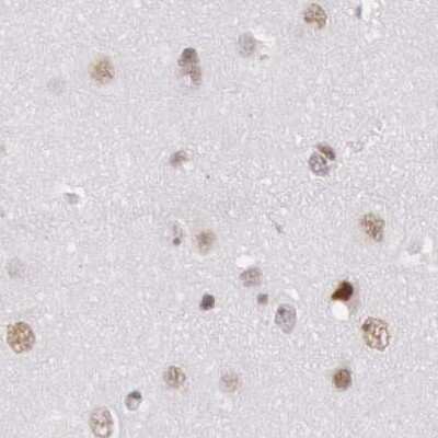 Immunohistochemistry-Paraffin: DGCR14 Antibody [NBP1-84257]