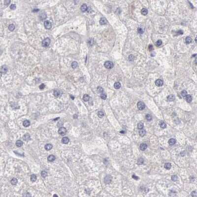 Immunohistochemistry-Paraffin: DGCR14 Antibody [NBP1-84257]