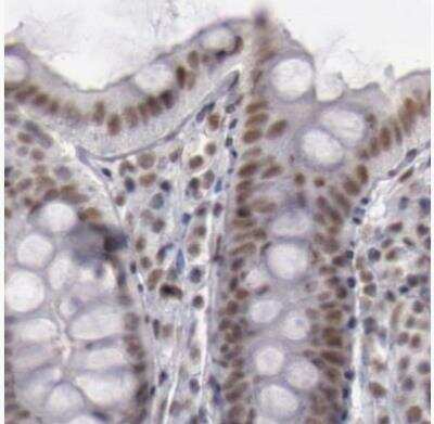 Immunohistochemistry-Paraffin: DGCR14 Antibody [NBP1-84258]