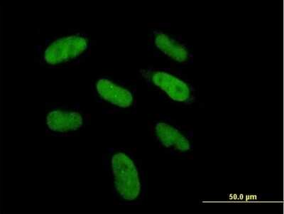 Immunocytochemistry/ Immunofluorescence: DGCR6 Antibody [H00008214-B01P]