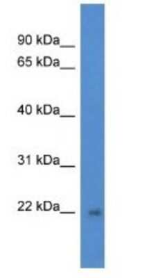 Western Blot: DGCR6L Antibody [NBP1-79875]