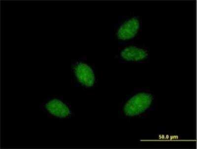 Immunocytochemistry/ Immunofluorescence: DGCR8 Antibody [H00054487-B01P]