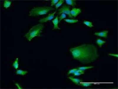 Immunocytochemistry/ Immunofluorescence: DGCR8 Antibody [H00054487-D01P]