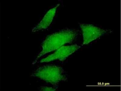 Immunocytochemistry/ Immunofluorescence: DGK-alpha Antibody [H00001606-B01P]