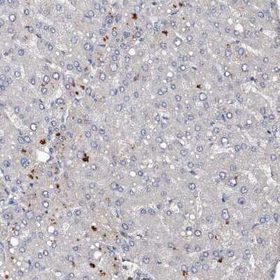 Immunohistochemistry-Paraffin: DGK-alpha Antibody [NBP2-13916]