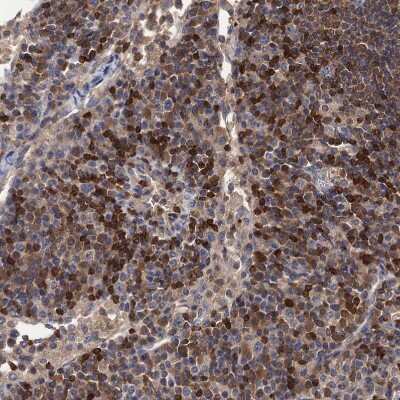 Immunohistochemistry-Paraffin: DGK-alpha Antibody [NBP2-13916]