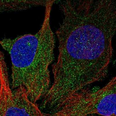 Immunocytochemistry/ Immunofluorescence: DGK-delta Antibody [NBP2-58630]